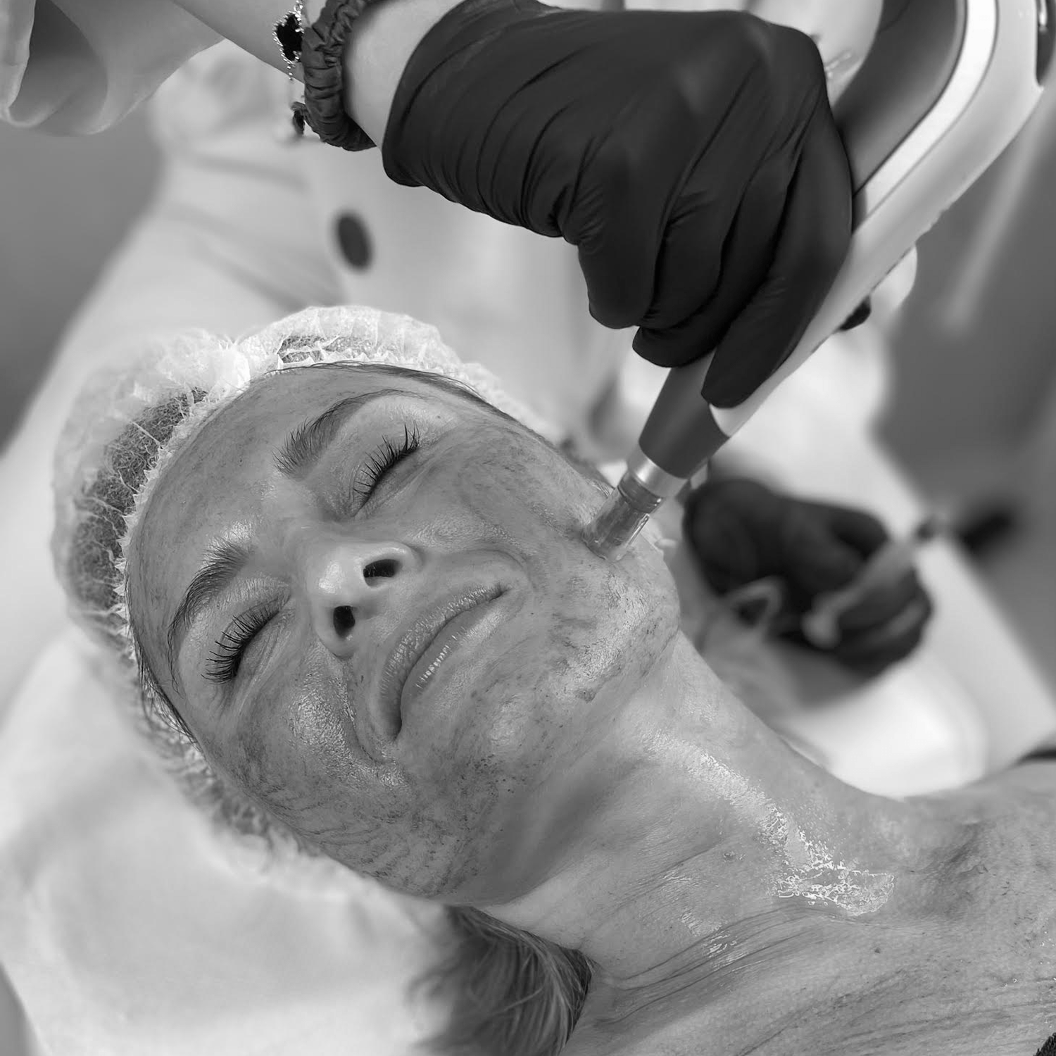 swiper-Fibryna bogatopłytkowa