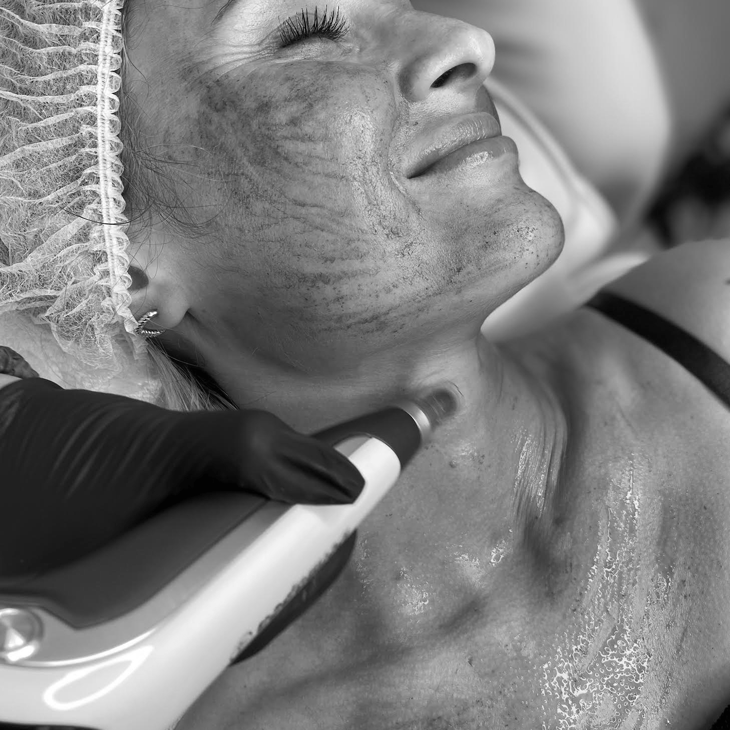 swiper-Osocze bogatopłytkowe