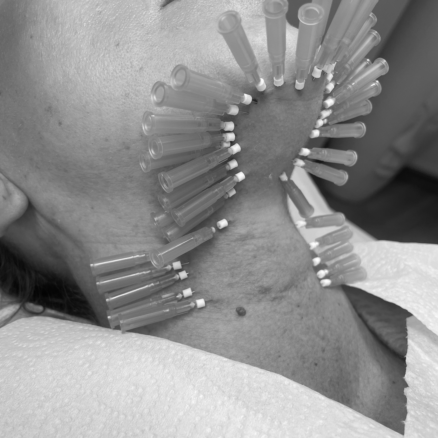 swiper-Nici PDO/PLLA