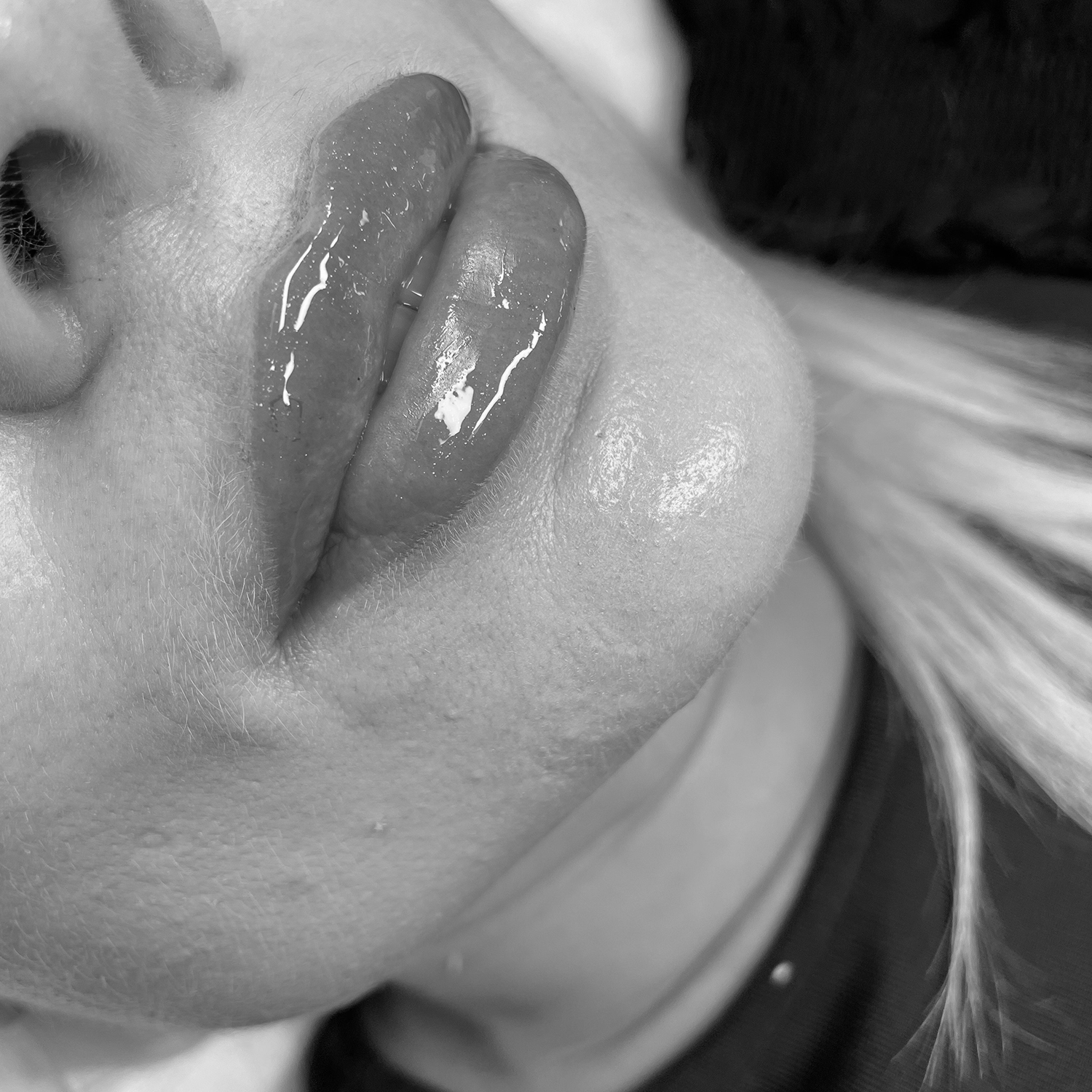 swiper-Modelowanie ust kwasem hialuronowym